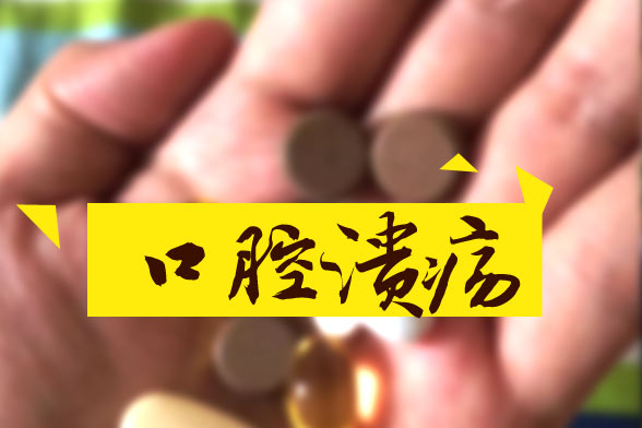 口腔潰瘍精神壓力是病因！四種小方法幫您治療口腔潰瘍