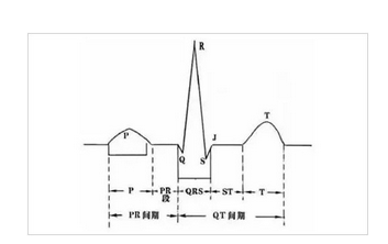 心電圖